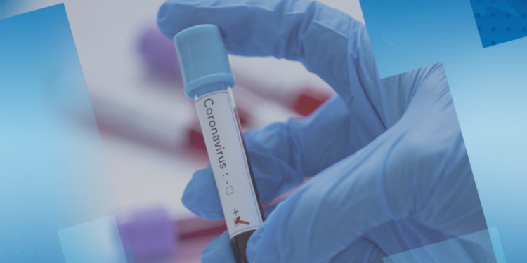 Имам ли вирус?