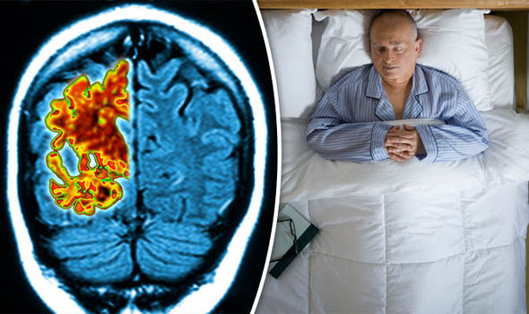 Възможна е връзка между дневния сън и деменцията